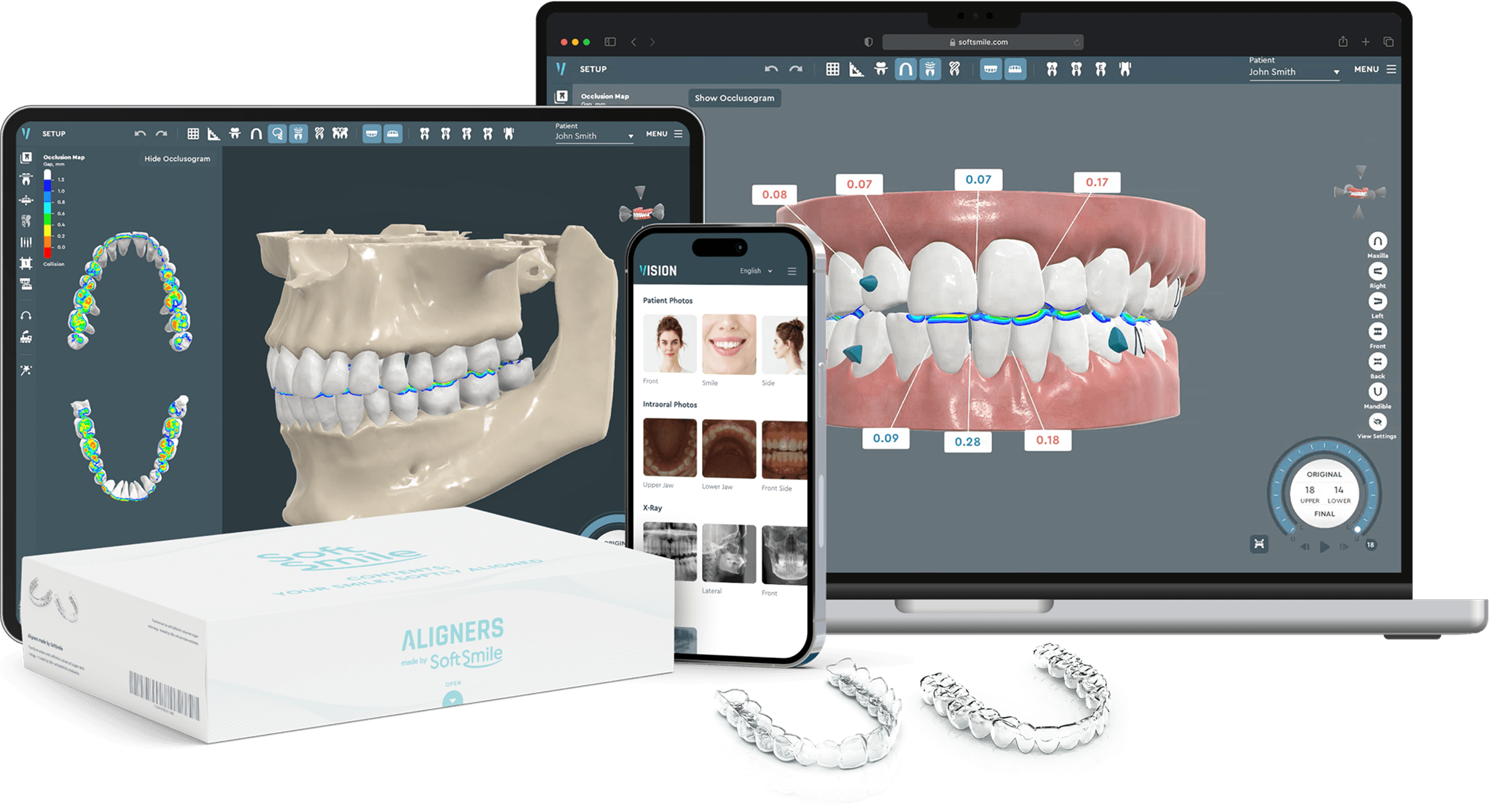 Aligner treatment planning software