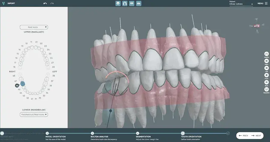 CBCT Scans