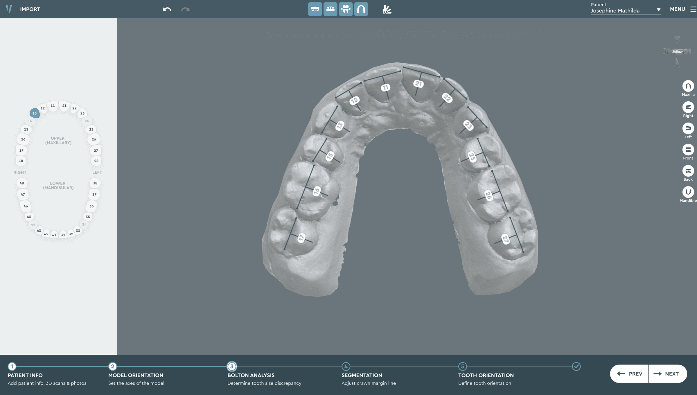 Software for Orthodontic Labs — Vision