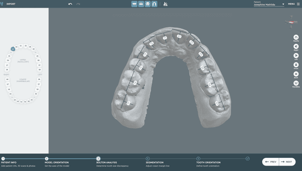Software for Orthodontic Labs — Vision