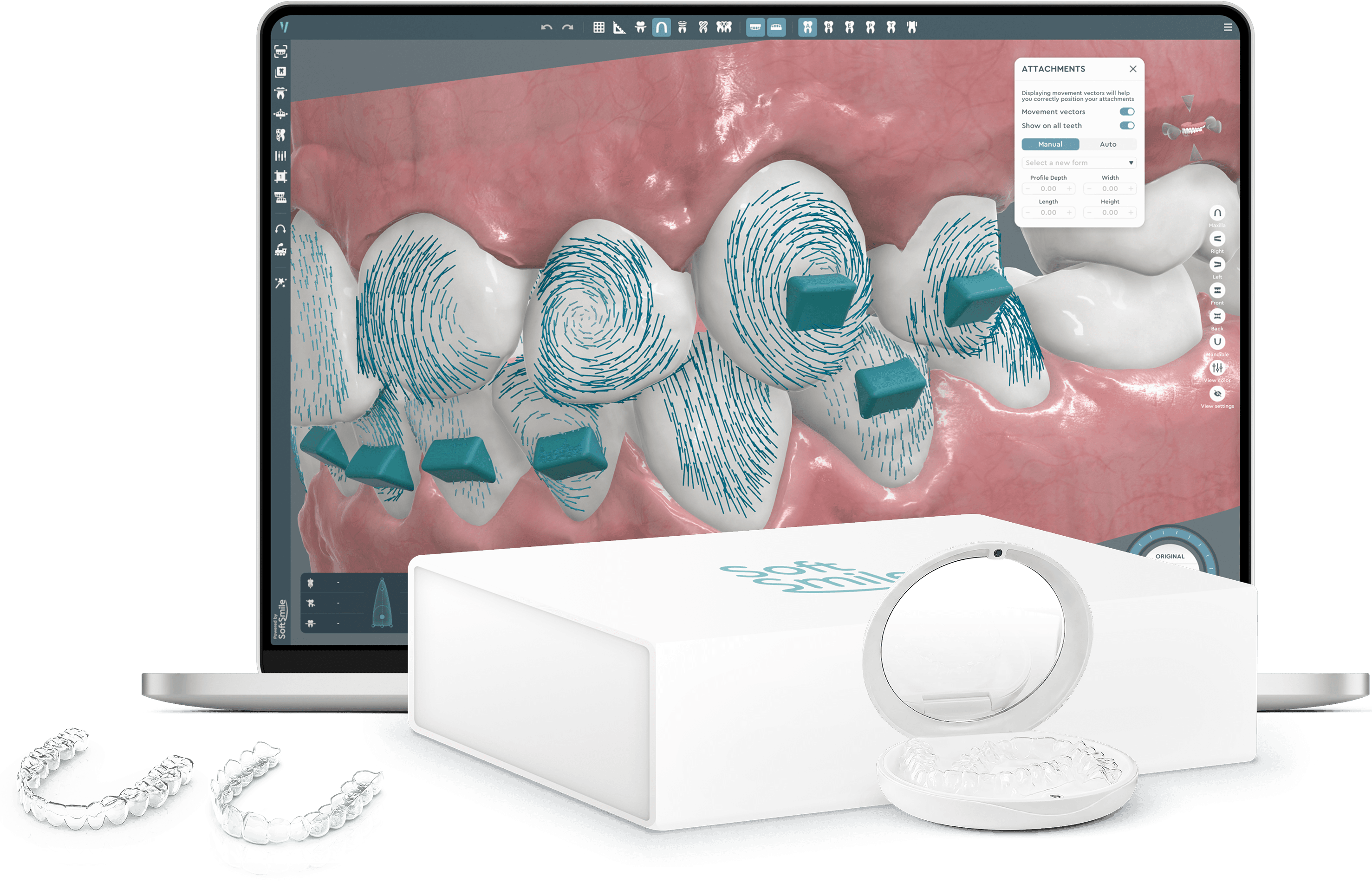 Aligner treatment planning software