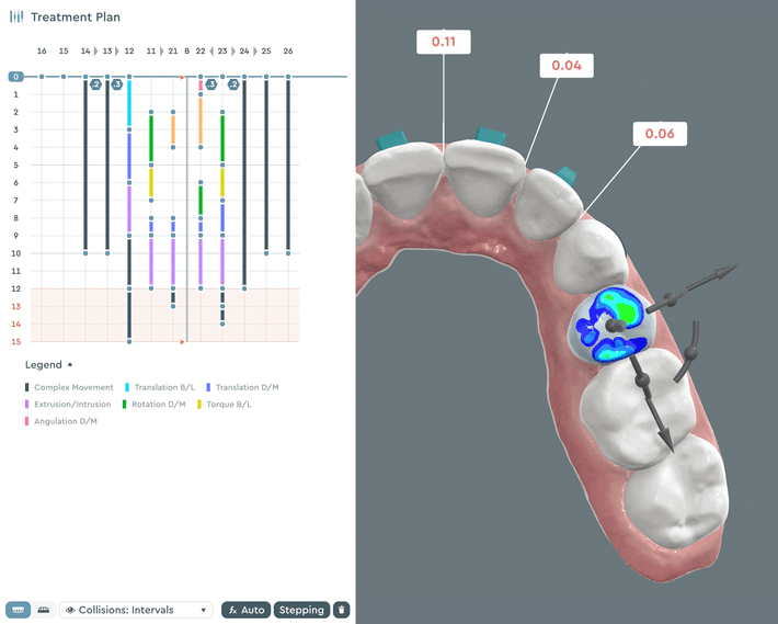 Virtual Articulator Feature