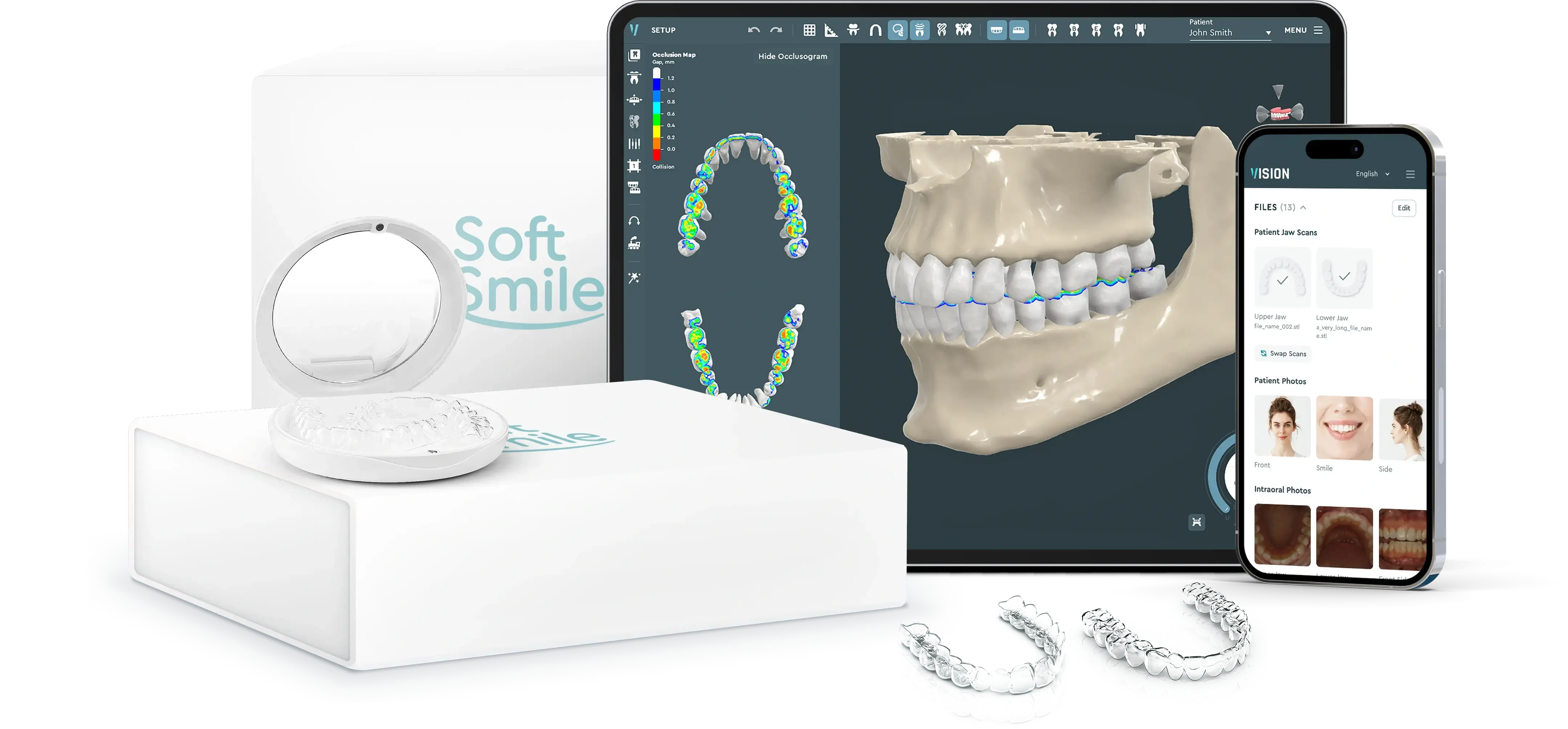Aligner treatment planning software