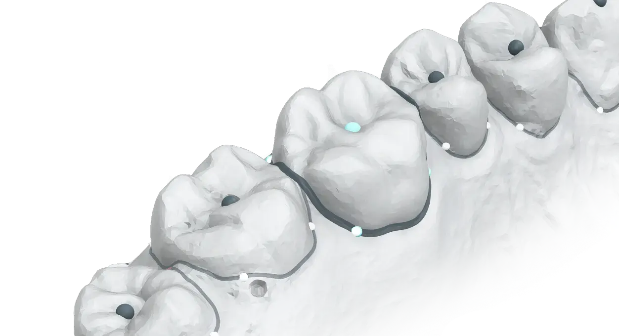 Aligner treatment planning software