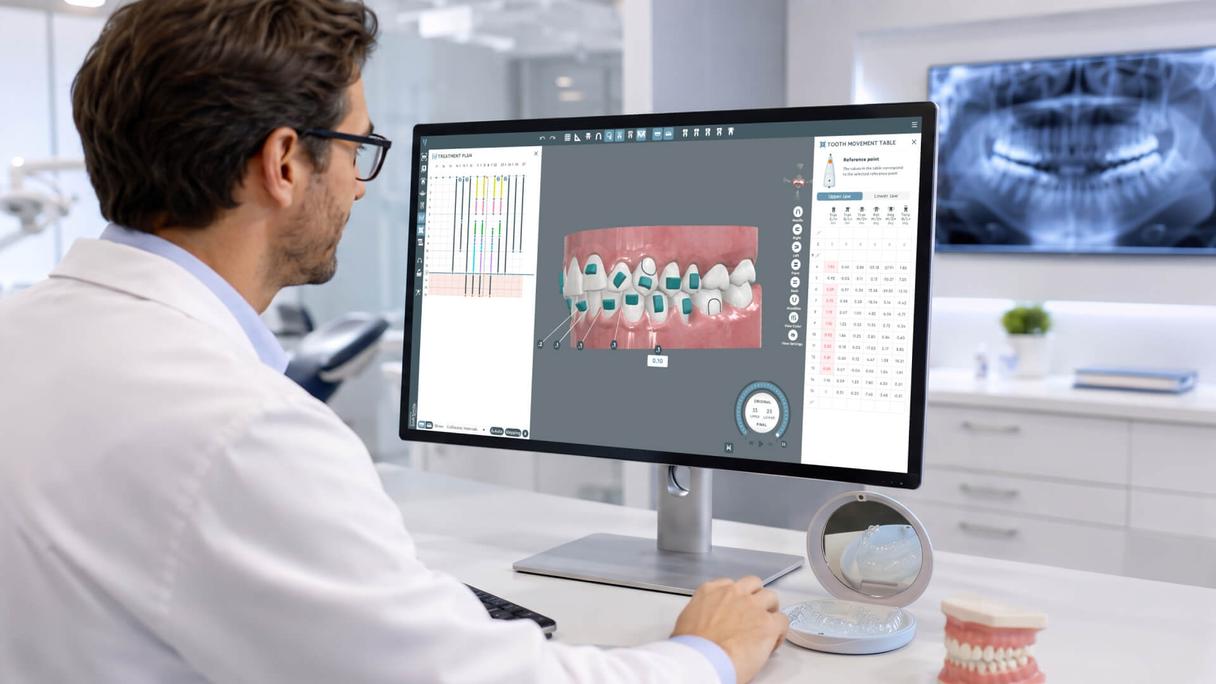 Digital treatment planning transforms clear aligner therapy—combining clinical expertise with precision technology for predictable outcomes Clear aligner treatment planning workflow with digital 3D simulation and aligner trays