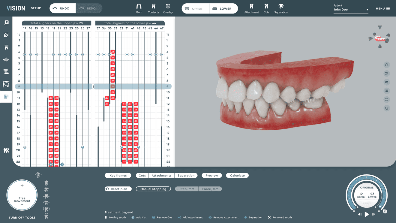 orthodontic treatment planning software