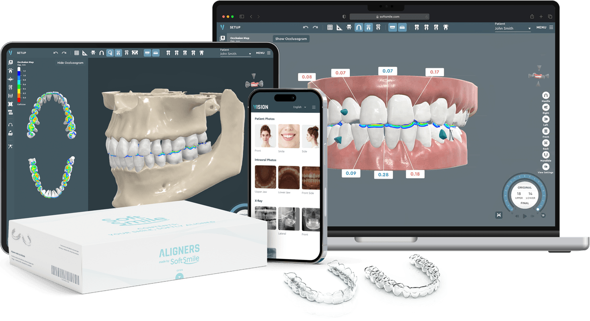 Aligner treatment planning software