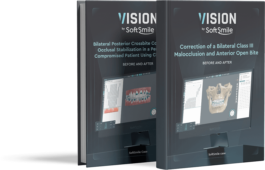 Aligner treatment planning software