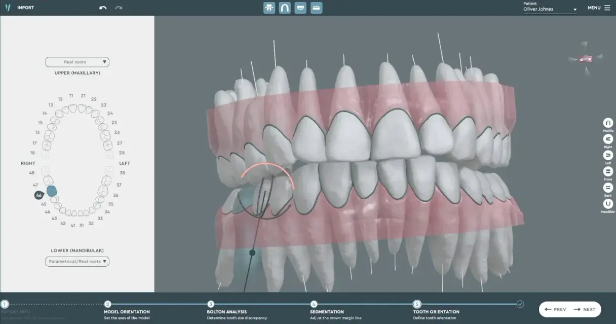 CBCT 3D Imaging