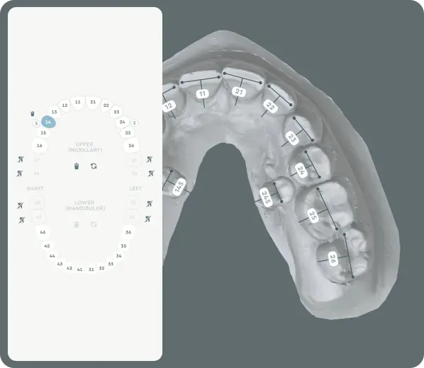 3D model featuring impacted or supernumerary teeth within the treatment plan