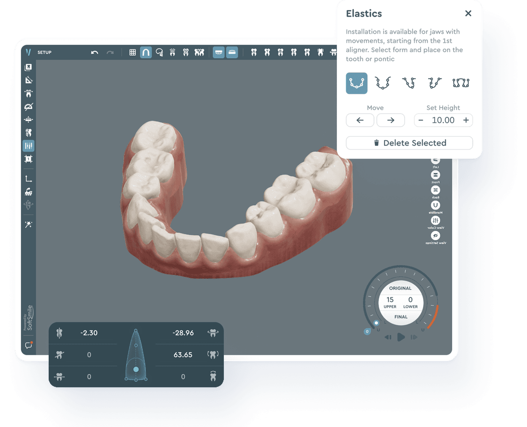 Aligner treatment planning software