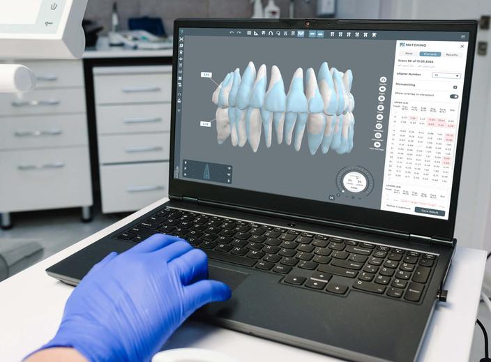 Orthodontist reviewing digital treatment planning software with 3D dental model on screen