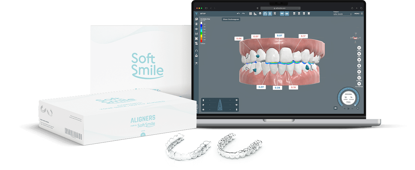 Aligner treatment planning software