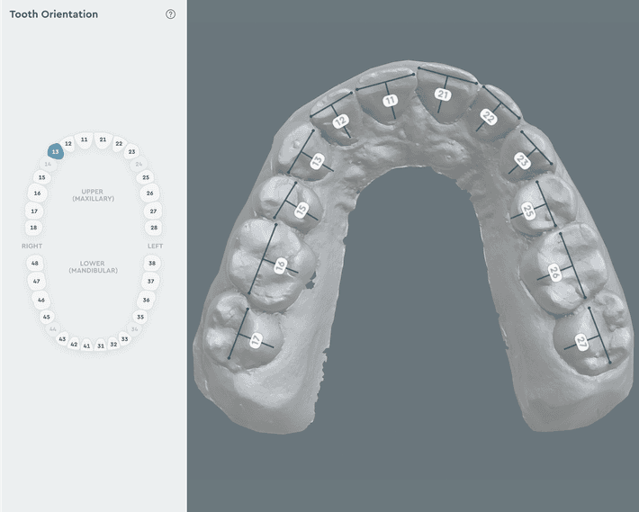 Additional Teeth Support
