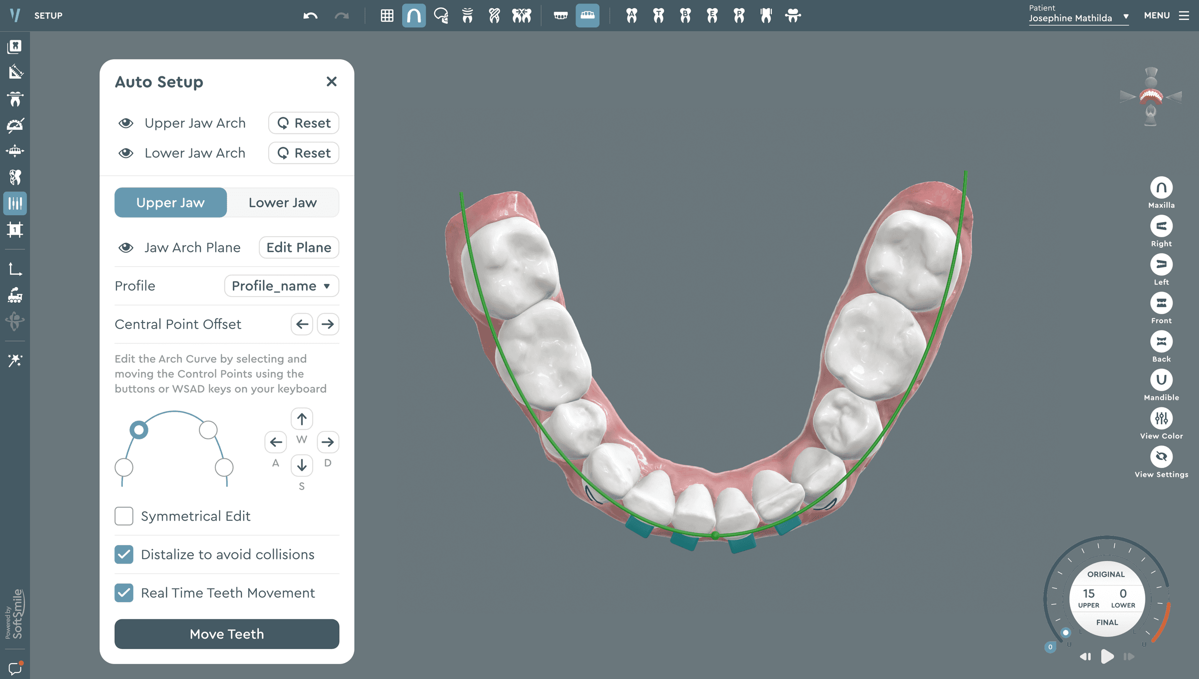 Software for Orthodontic Labs — Vision