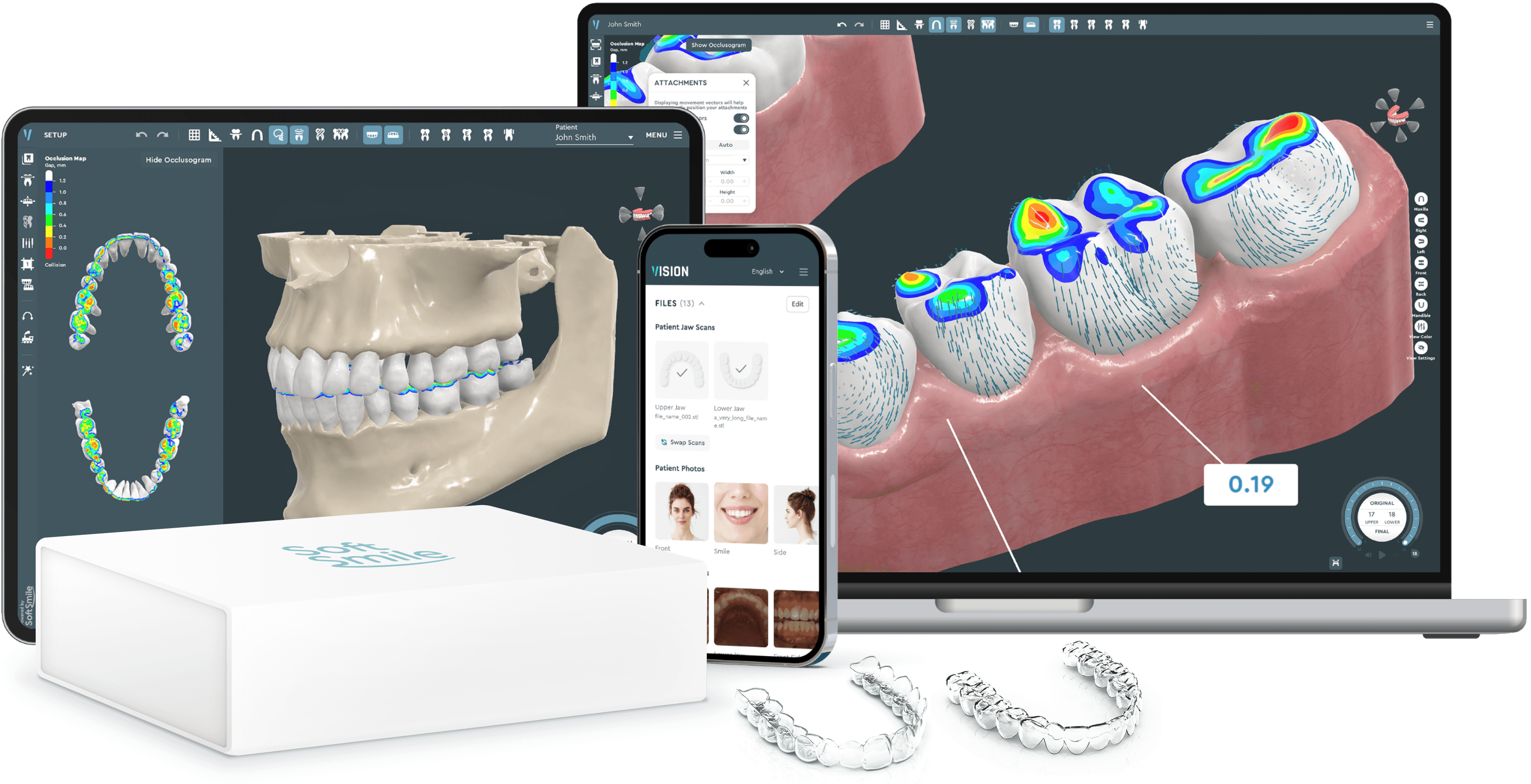 Aligner treatment planning software